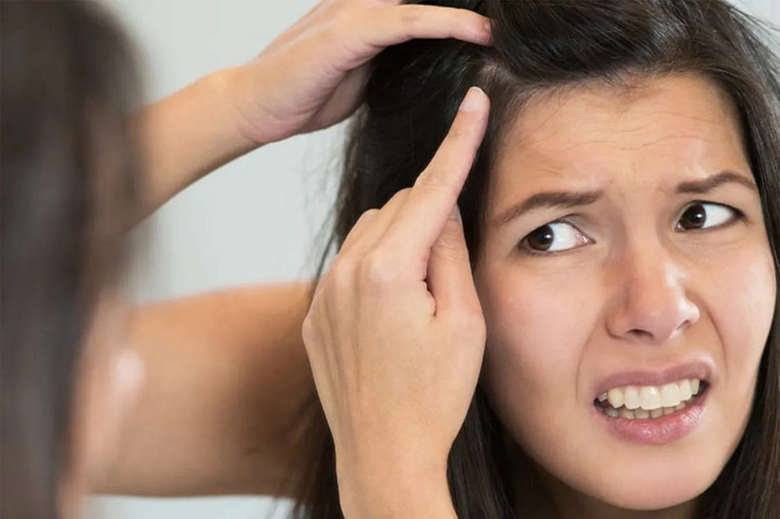 How Chemical Dyes Can Lead to Premature Greying