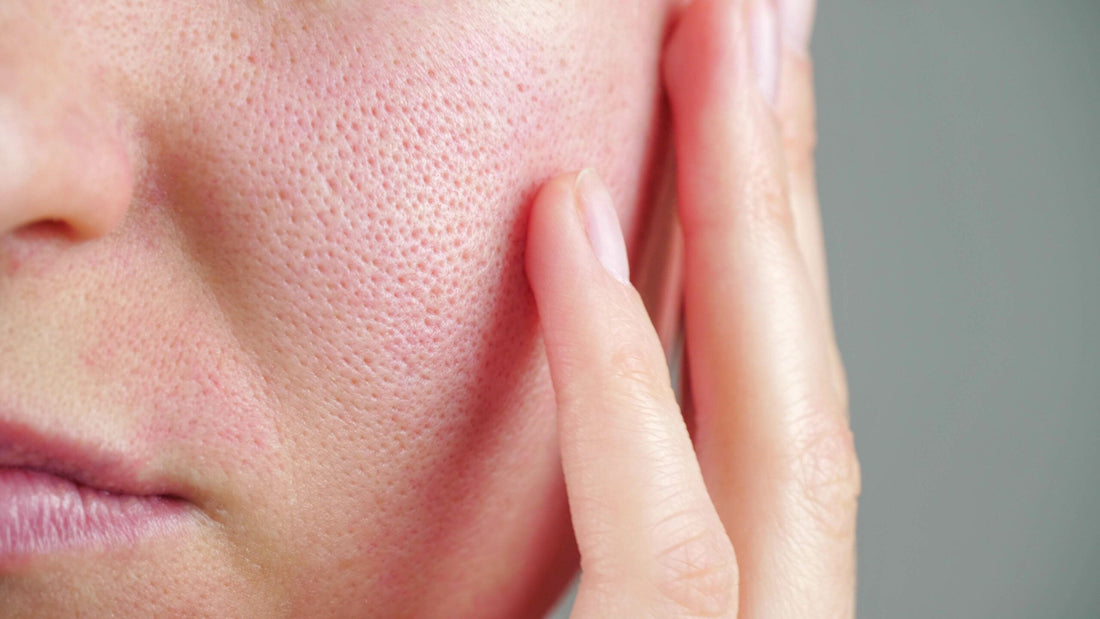 Open Pores Skincare Routine That Works
