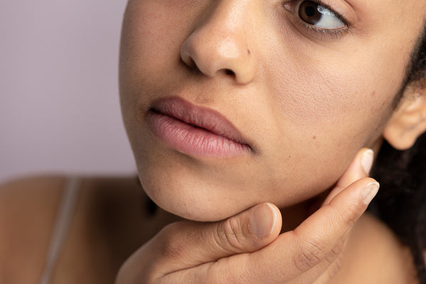 Do You Use Harsh Actives To Treat That Pigmentation Around Mouth? Here's A Natural Solution