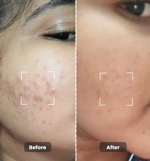 Sensitive Skin Combo