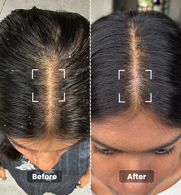 Intensive Anti Dandruff Shampoo Mini 50ml