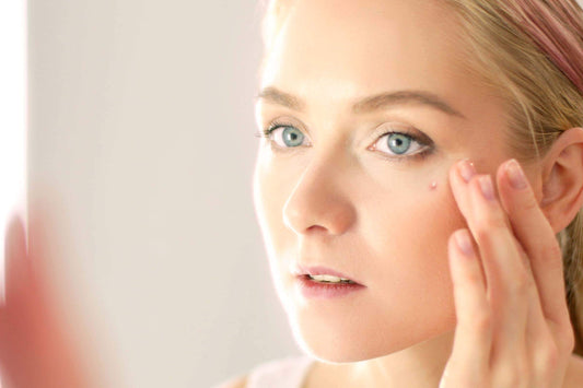 How To Get Rid Of Whiteheads On Face?