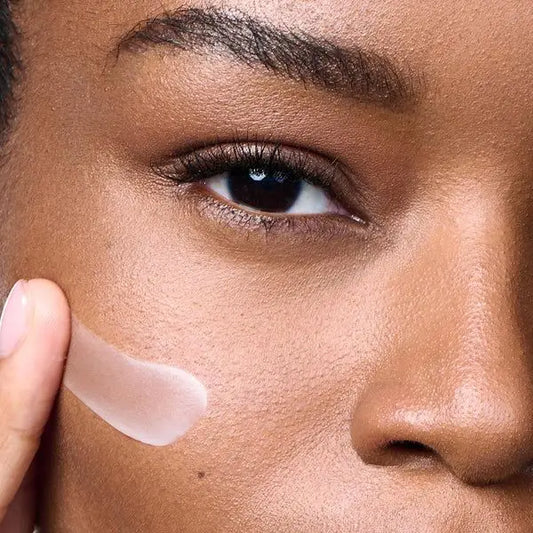Does Sunscreen Cause Acne