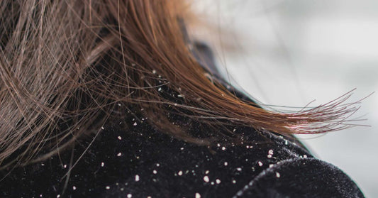 Haircare Calendar to banish dandruff