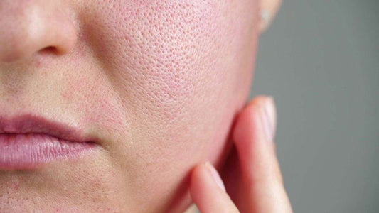 Important Points You Should Keep In Mind If You’re A Sensitive Skin