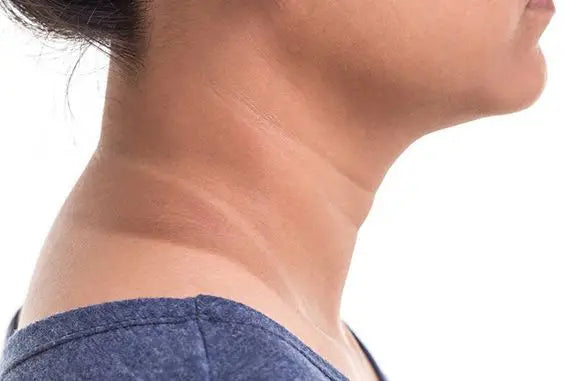 How To Get Rid Of Neck Pigmentation