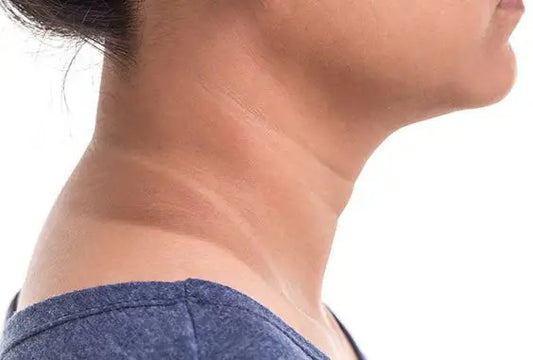 How To Get Rid Of Neck Pigmentation