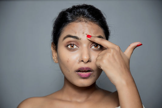 How to Remove Dark Spots in Face