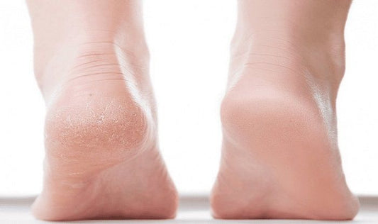 Essential Foot Care Tips for Healthy, Happy Feet