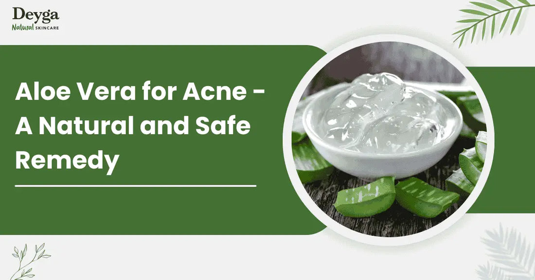 Aloe Vera Gel for Acne - A Natural and Safe Remedy