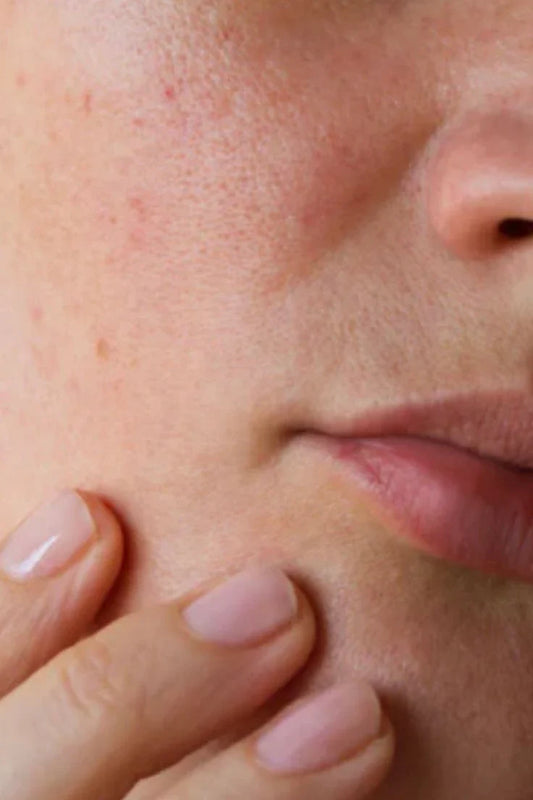 How To Remove Dead Skin From Face