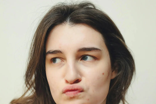 Dark Spot Removal Cream by Dermatologist