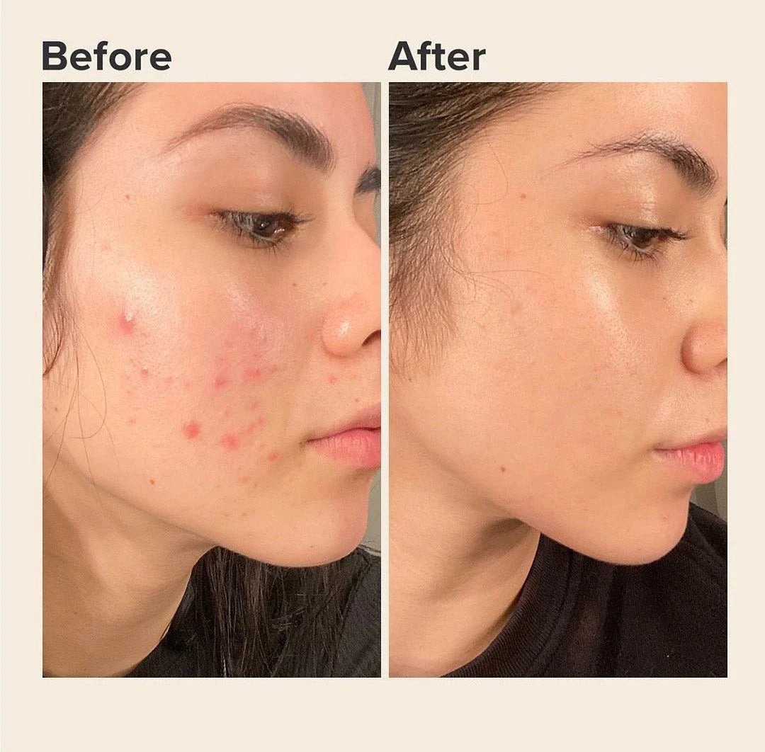 Does Vitamin C Lighten Skin