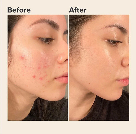 Does Vitamin C Lighten Skin
