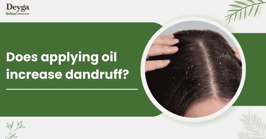 Does applying oil increase dandruff?