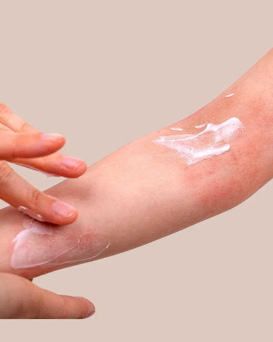 How To Treat Skin Rash
