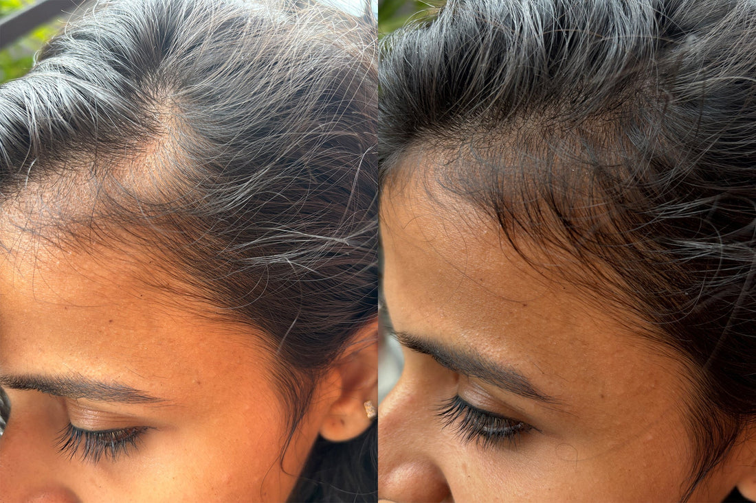 I Tried This Hair Growth Trio for 30 Days