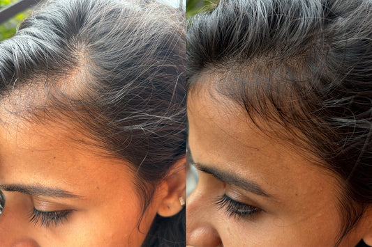 I Tried This Hair Growth Trio for 30 Days