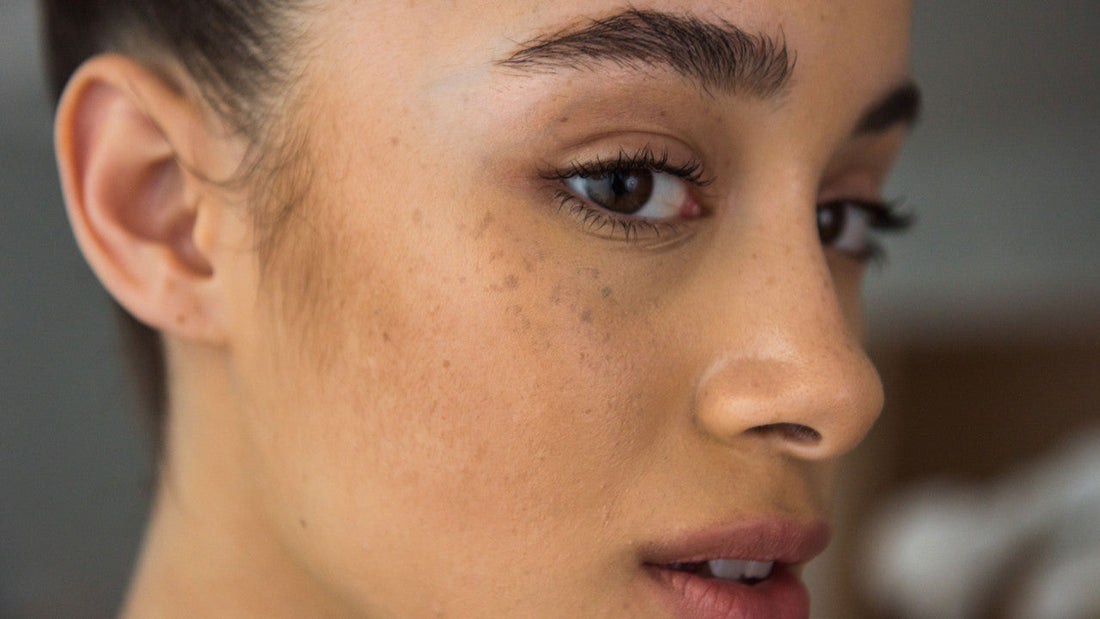 Fret Not For Dark Spots!