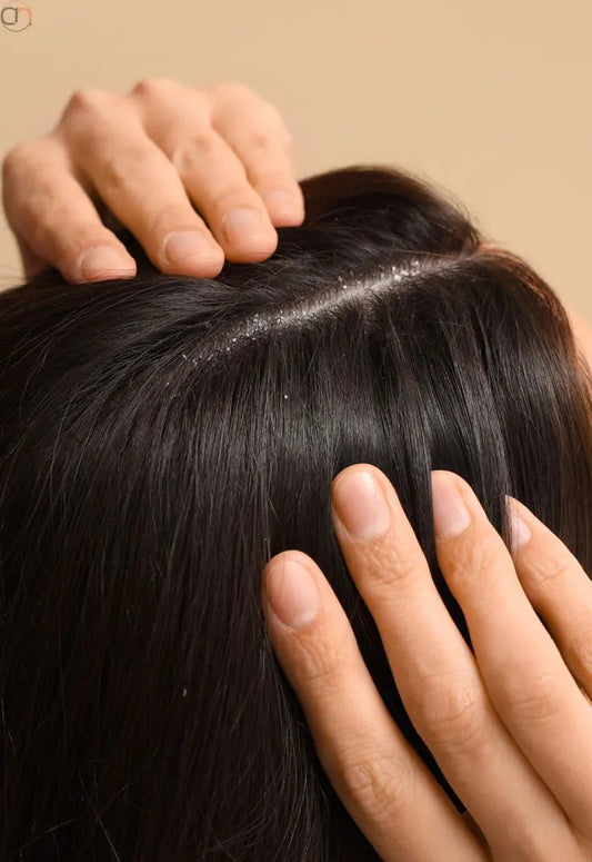 How To Avoid Dry Scalp