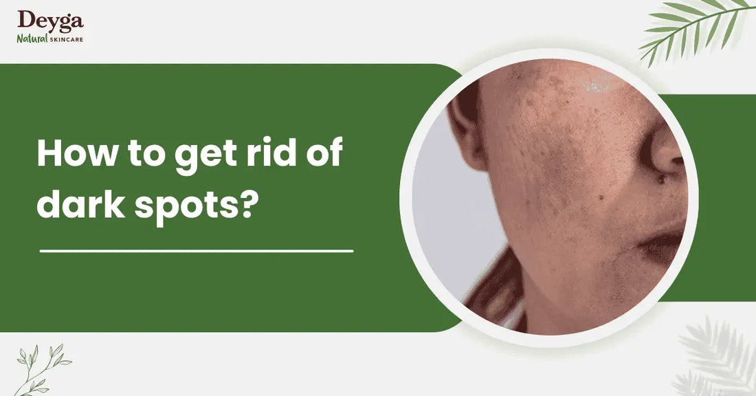 How to get rid of dark spots?
