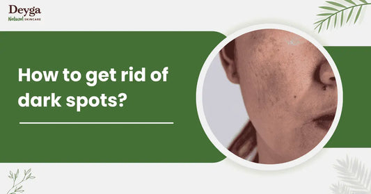 How to get rid of dark spots?