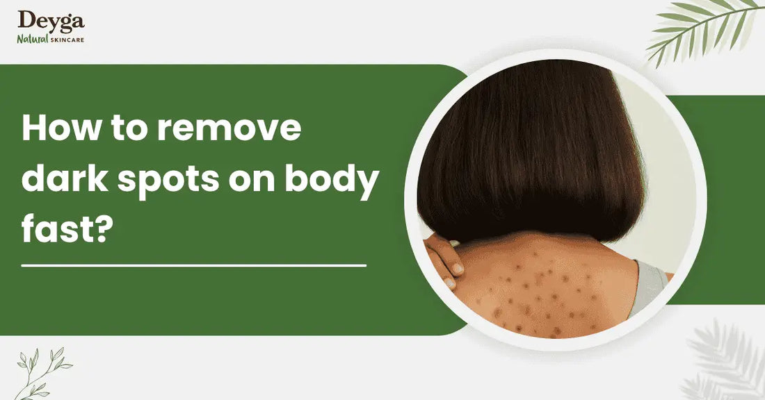 how to remove dark spots on body fast?