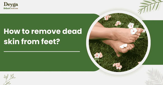 How to Remove Dead Skin from Feet?