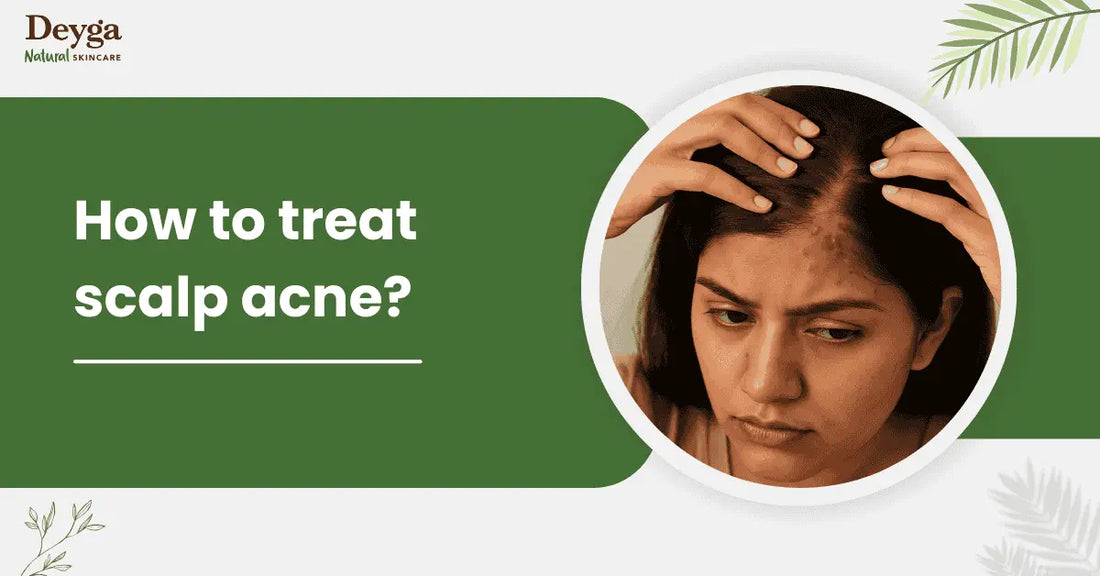 How to treat scalp acne?