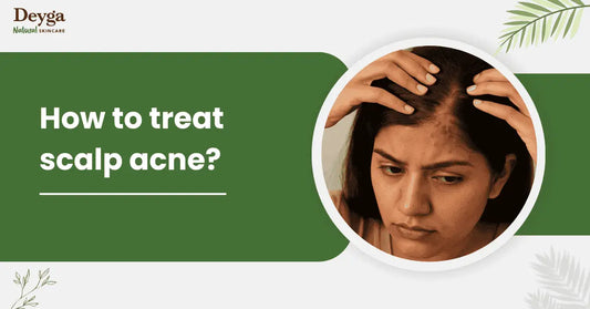How to treat scalp acne?