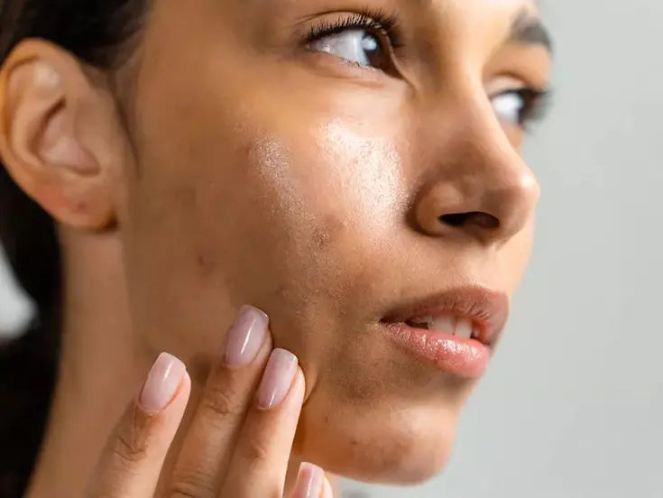 Dull Complexion