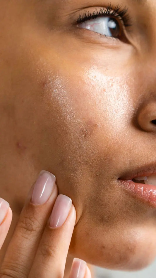 How To Get Rid Of Uneven Skin Tone