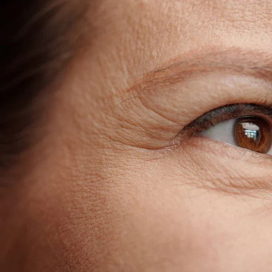 How To Remove Wrinkles Under Eyes