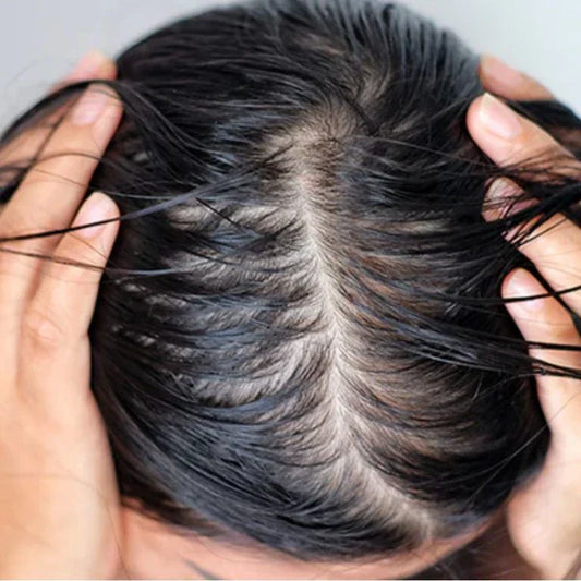 Which Shampoo Is Best For Oily Scalp
