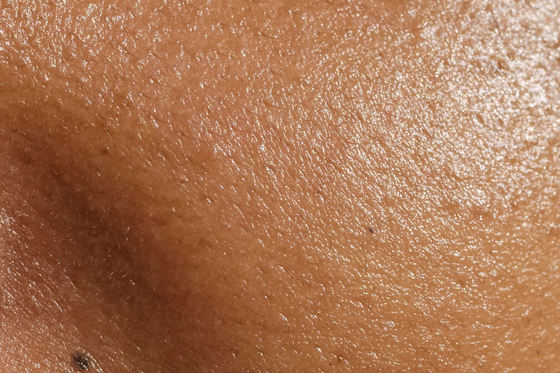 Open Pores Cream Dermatologist Recommended