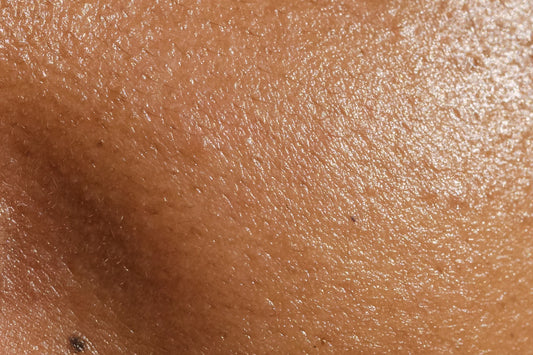 Open Pores Cream Dermatologist Recommended