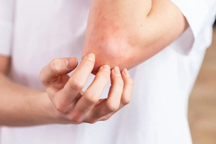 Why Skin Rashes Occur