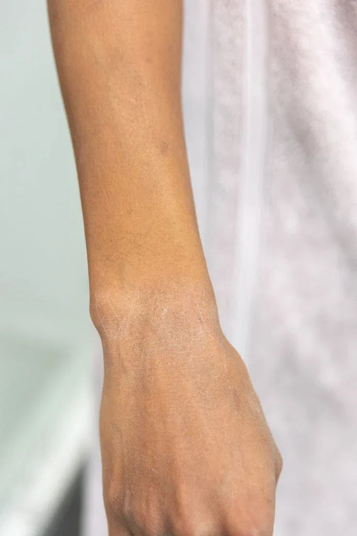 How To Remove Dead Skin From Body
