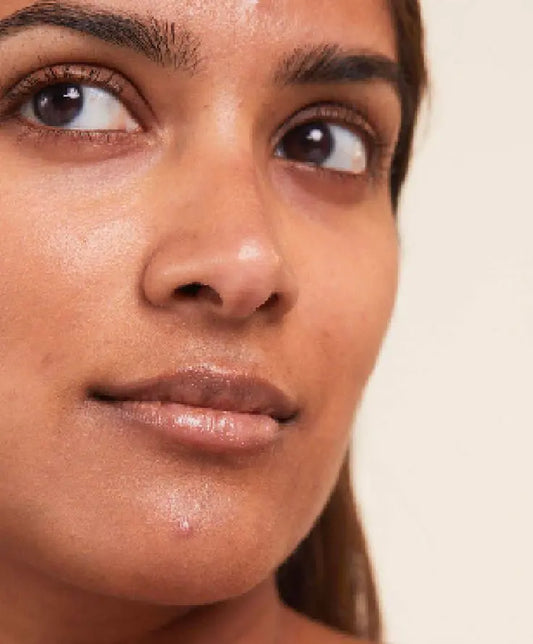 When Does Pregnancy Acne Start