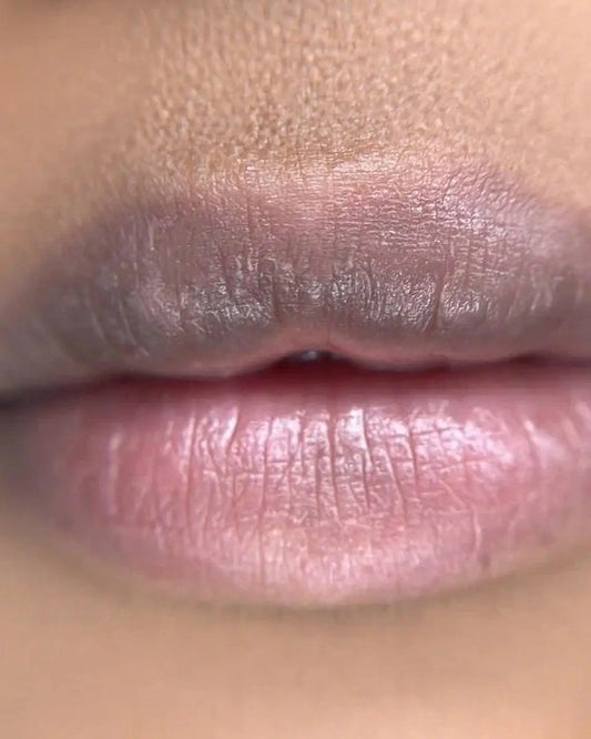 How To Remove Upper Lip Darkness
