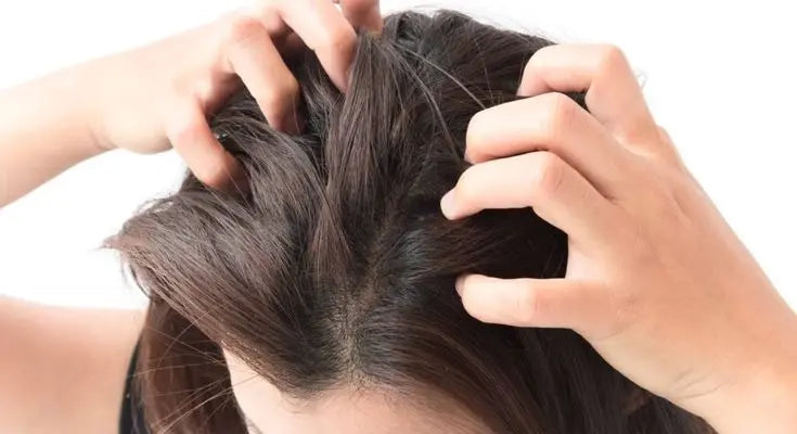 How To Reduce Itchy Scalp
