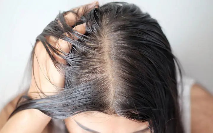 How To Get Rid Of Oily Scalp