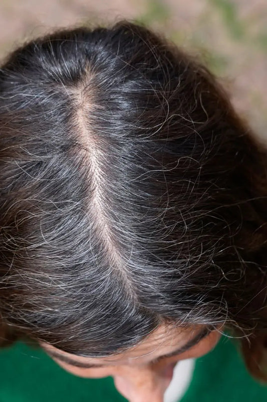 How To Stop Gray Hair At Early Age