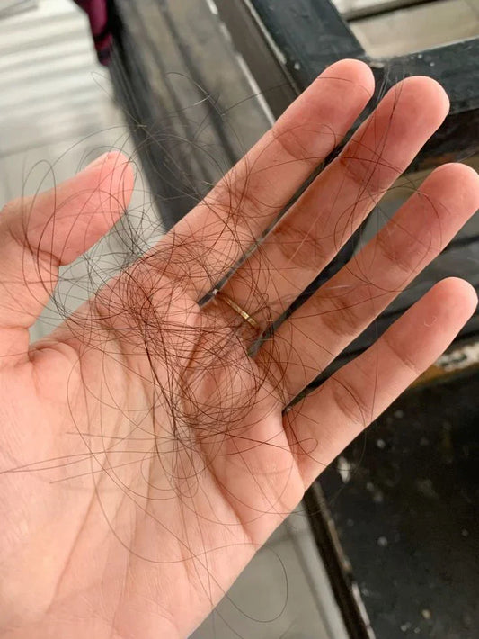 How To Prevent Hair Fall For Female