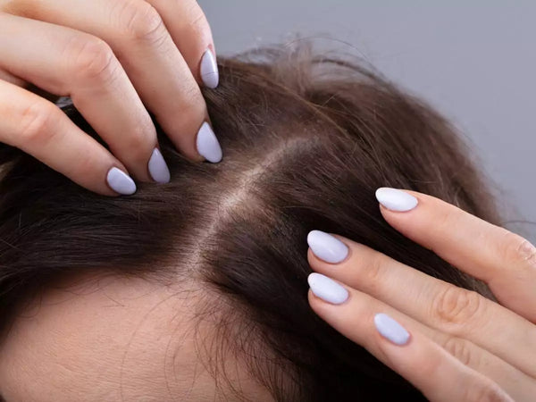 WHAT IS SCALP ACNE AND HOW TO TREAT IT?
