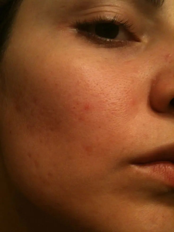 How To Minimize Pores Naturally
