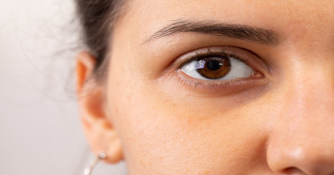 ARE YOUR DARK CIRCLES TOO DARK FOR YOUR UNDER-EYE CREAM