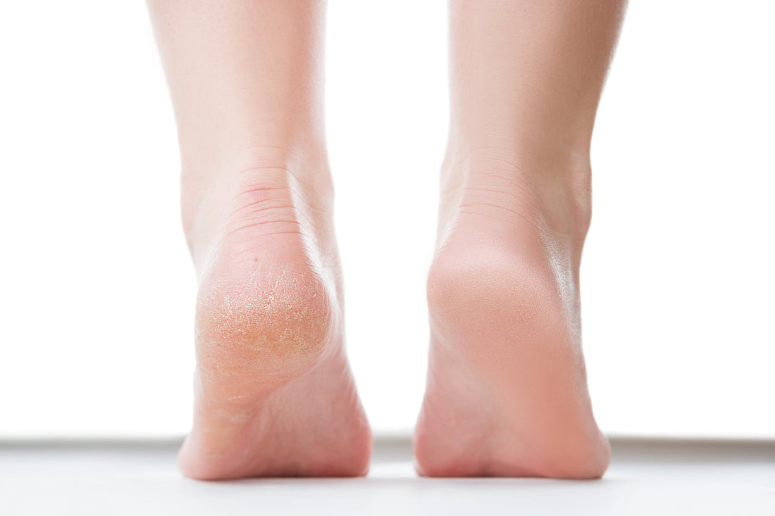  DEYGA’S FOOT BUTTER