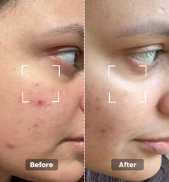 2% Hyaluronic Serum - Intense Hydration 20ml