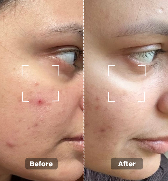 2% Hyaluronic Serum - Intense Hydration 20ml
